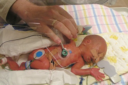 Alex 2 days